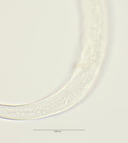 lateral field at cloaca region, 100x