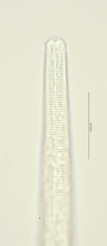 lateral field at head region, 100x