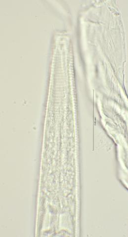 head region with cephalic setae, 100x