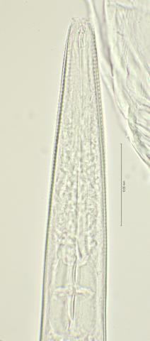 head region with dorsal tooth, 100x