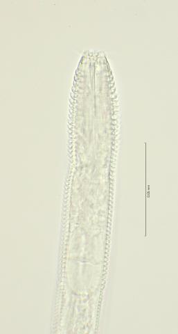 head region with dorsal tooth, 100x