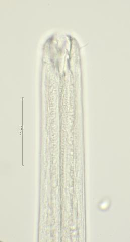 head region with dorsal tooth, 100x