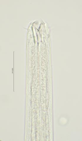 head region with left subventral tooth, 100x