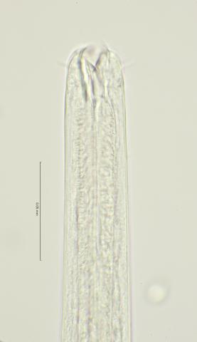 head region with right subventral tooth, 100x