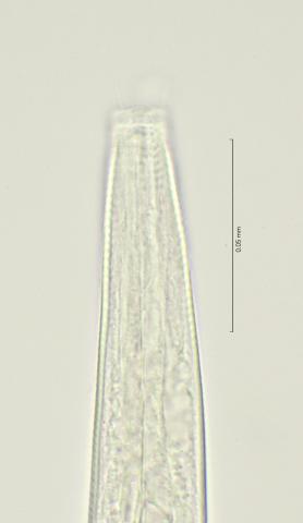 head region with cephalic setae and amphid, 100x