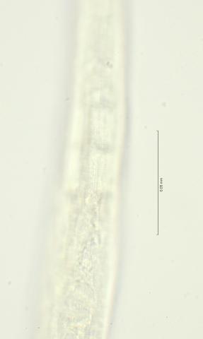 lateral field oesophagus end, 100x