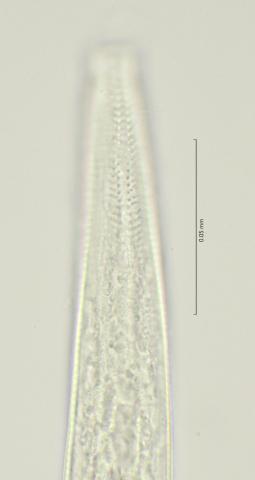 lateral field upper oesophagus region, 100x