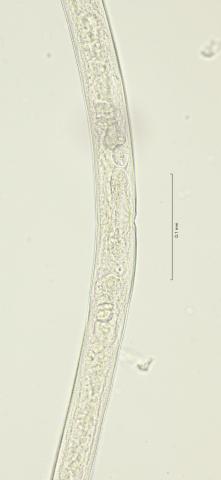 vulva region, 40x