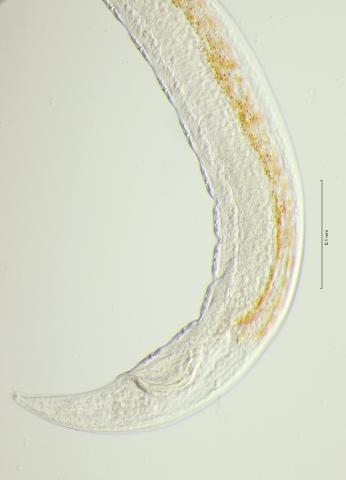 tail region, 40x, obligue lighting