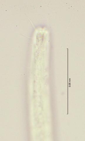 head region with amphid, 100x