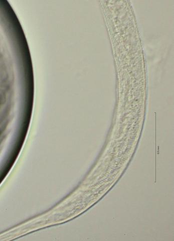 lateral field at cloaca region, 100x, obligue lighting