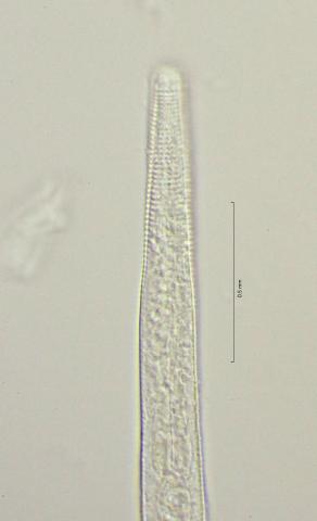 lateral field at head region, 100x, obligue lighting