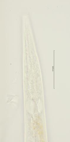 lateral field upper oesophagus region, 100x