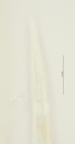 lateral field oesophagus end , 100x