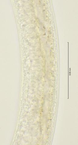 minute precloacal papillae 100x