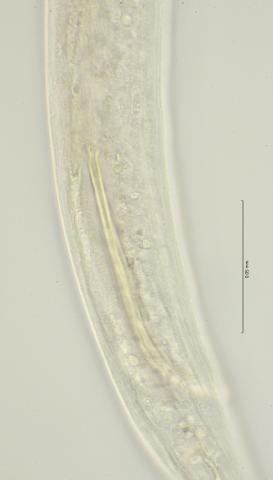 proximal end right spiculum, 100x