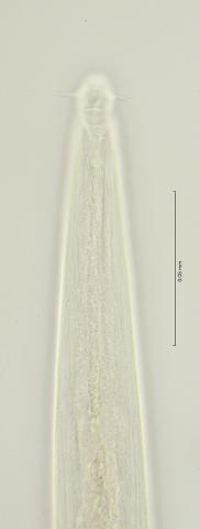 head region with amphid, 100x