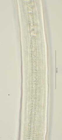 cuticula ornamentation at mid body, 100x