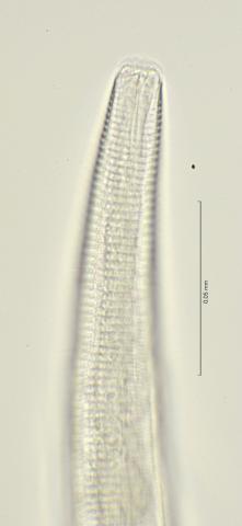 head region with dorsal tooth, 100x