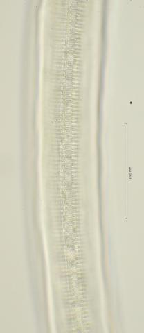 lateral field at mid body, 100x