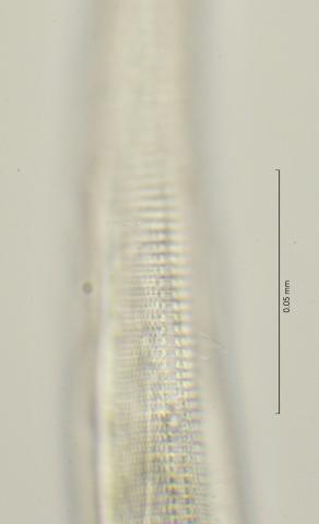 lateral field at oesophagus end, 100x