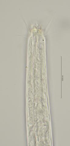 head region with cephalic setae, 100x