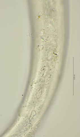 lateral field at cloaca region, 100x