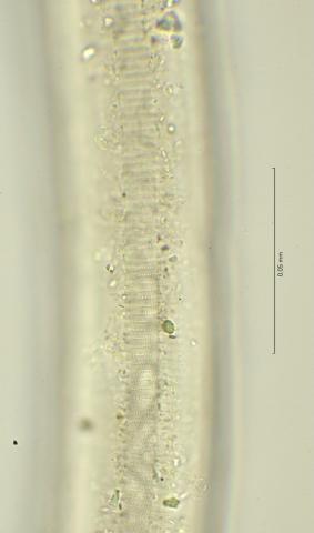 lateral field at mid body, 100x