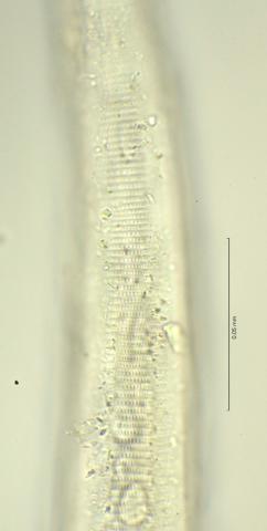 lateral field at oesophagus end, 100x