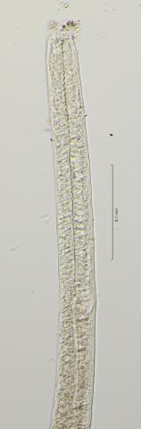 oesophagus region, 40x, obligue lighting