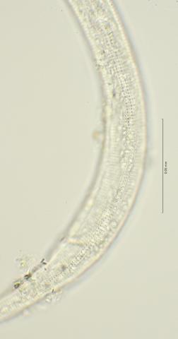 lateral field at cloaca region, 100x