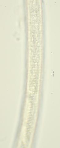 lateral field at mid body, 100x