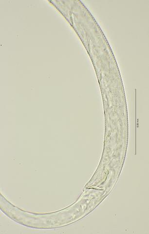 cloaca region, 100x stack