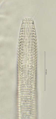 head region with dorsal tooth, 100x