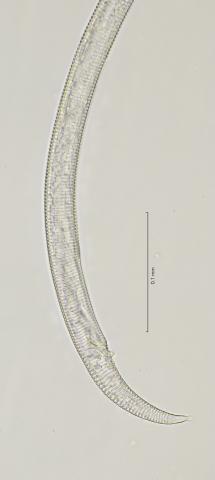 tail region, 40x stack