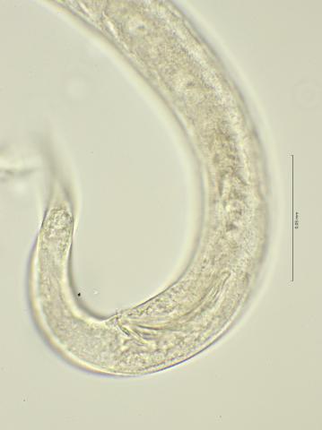 tail region, 100x