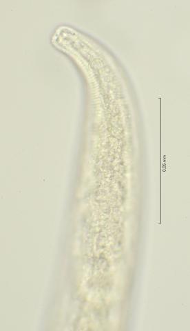 head region with amphid, 100x