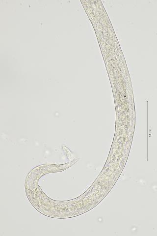 tail region, 40x, stack