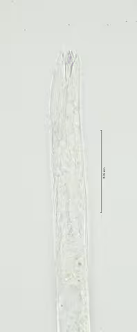 head region 100x stack