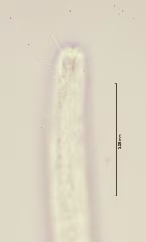 head region w amphid 100x