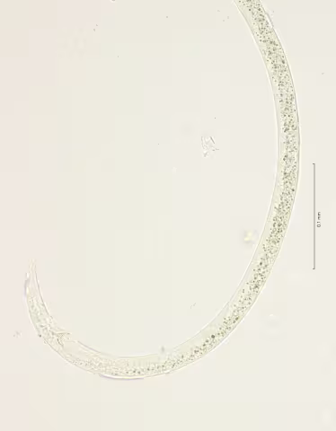 tail region 40x stack