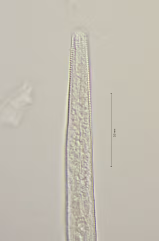 head region w cephalic seta 100x obligue