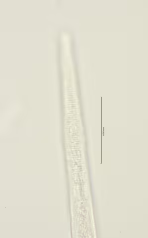 lateral field oesophagus region 100x