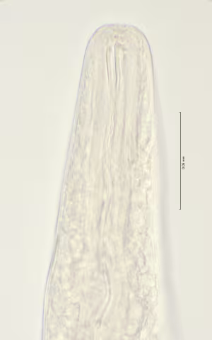 head region w dorsal tooth 100x