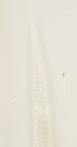 lateral field oesophagus end 100x