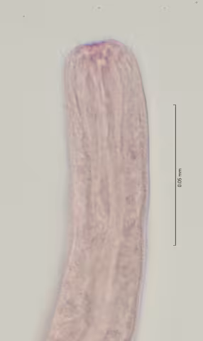 head region w cephalic setae 100x