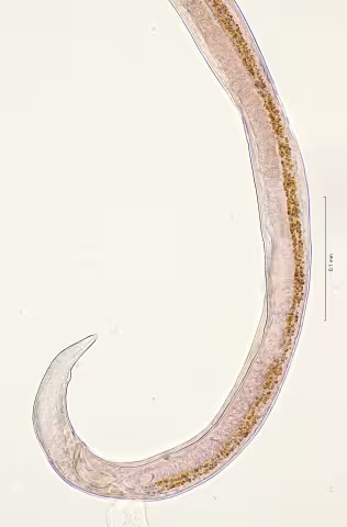 tail region 40x stack