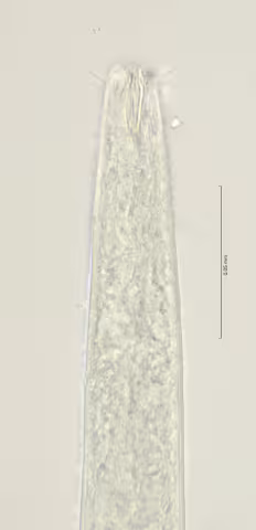 head region 100x stack