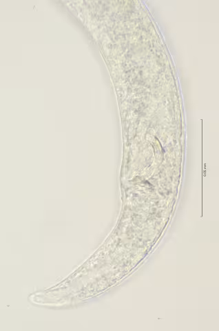 tail region 100x stack