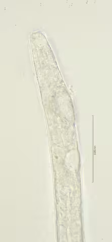 head region 100x stack